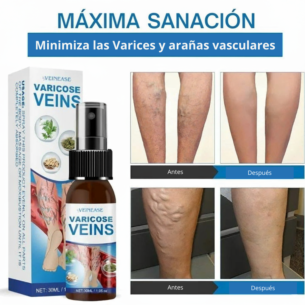 NUEVO VENOSPLUS® Spray mentolado